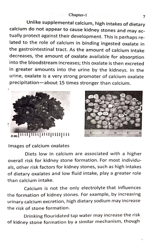 Ayurvedic Remedies for Kidney Stones